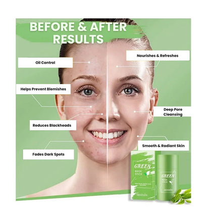 TeaMask® – Deep-Cleansing Green Tea Mask